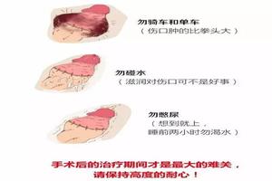 昌吉哪些地方可以割包皮(昌吉正规的男科医院在哪里)